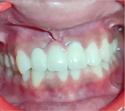 Before dental treatment